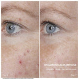 Ampollas Ácido Hialurónico Doctor Babor - Babor Cosmetics - Pepa Navarro Centro de Estética Avanzada