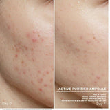 Ampollas Active Purifier Babor - Babor Cosmetics - Pepa Navarro Centro de Estética Avanzada