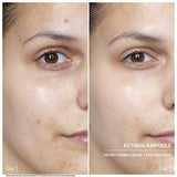 Ampollas de Retinol Doctor Babor - Babor Cosmetics - Pepa Navarro Centro de Estética Avanzada